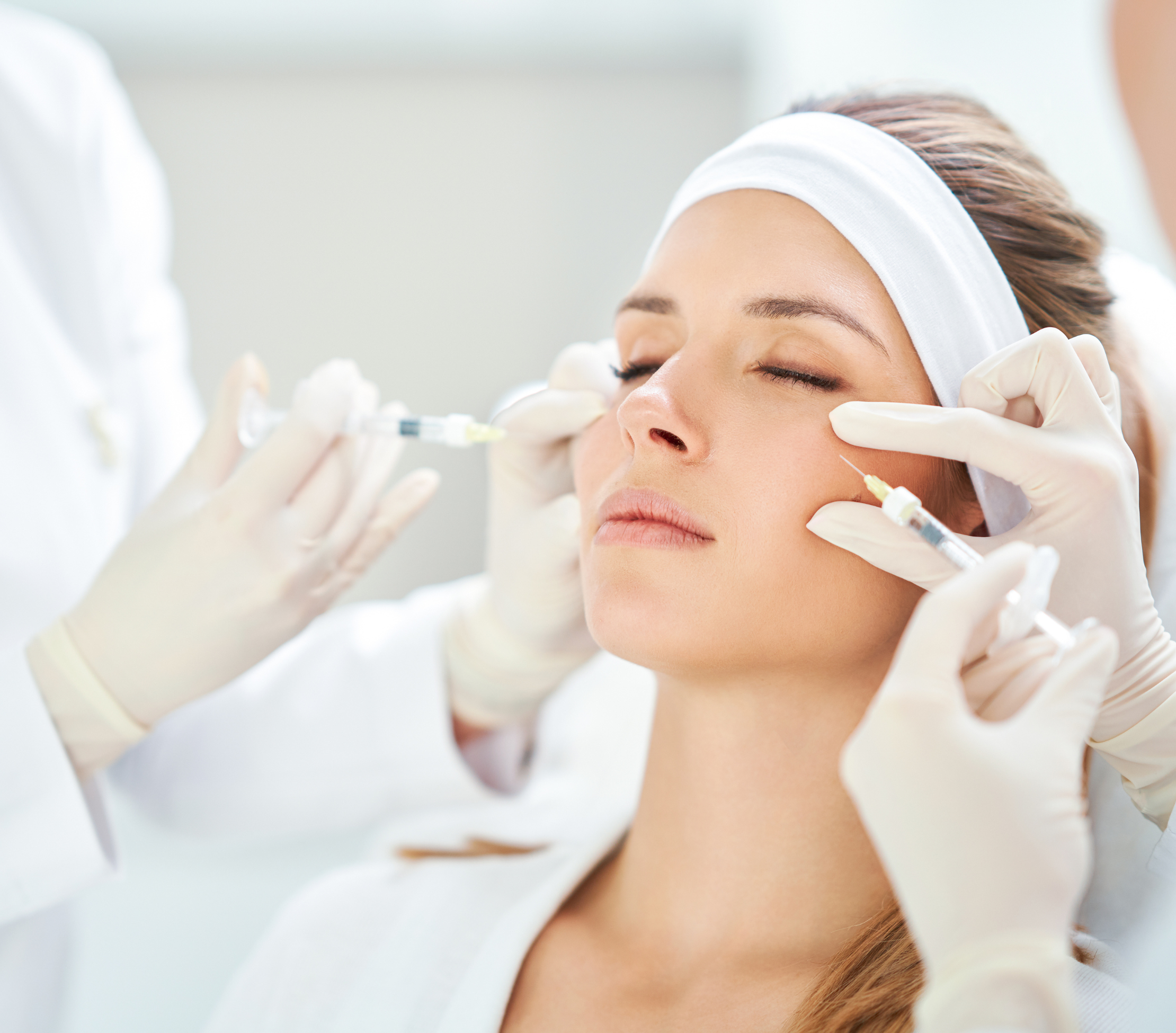 Under-Eye Rejuvenation with Dermal Fillers