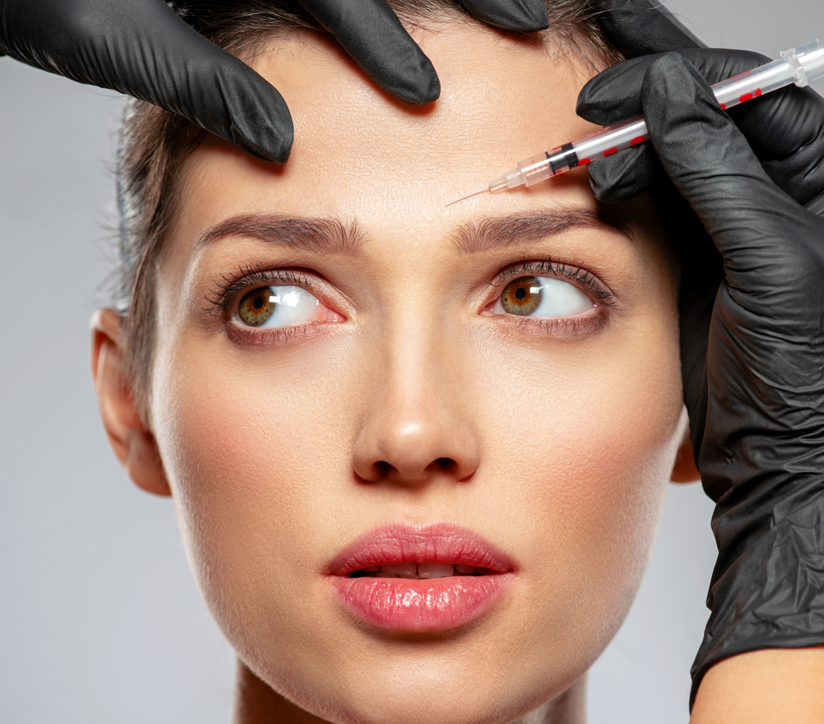 Botulinum Toxin – Forehead Rejuvenation