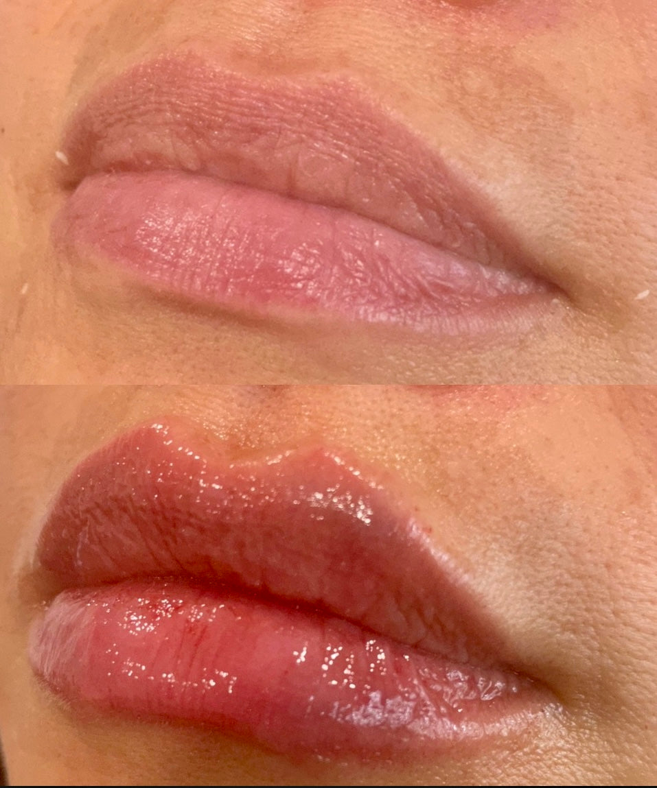 Lip Flip